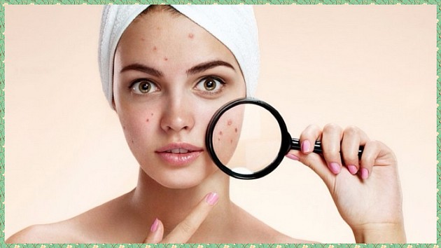 Воспаления на лице