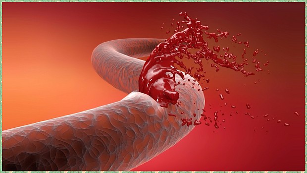 Виды анемии