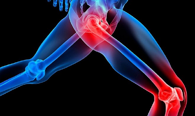 5 правил управления болью при артрите