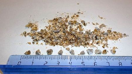 Методы очищения почек народными средствами