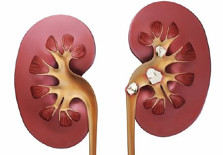 Чистка почек народными средствами в домашних условиях