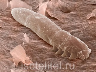 Лечение демодекоза