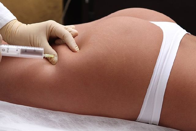 Мезотерапия: что это