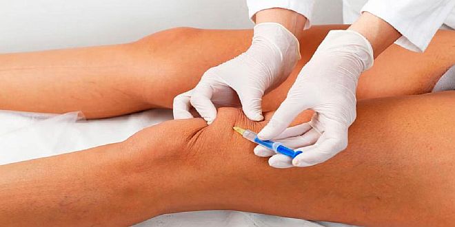 Остеоартрит: как прекратить износ суставов