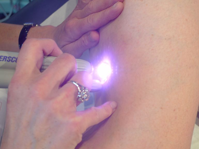 Флеболог - Флебология: когда и зачем консультироваться