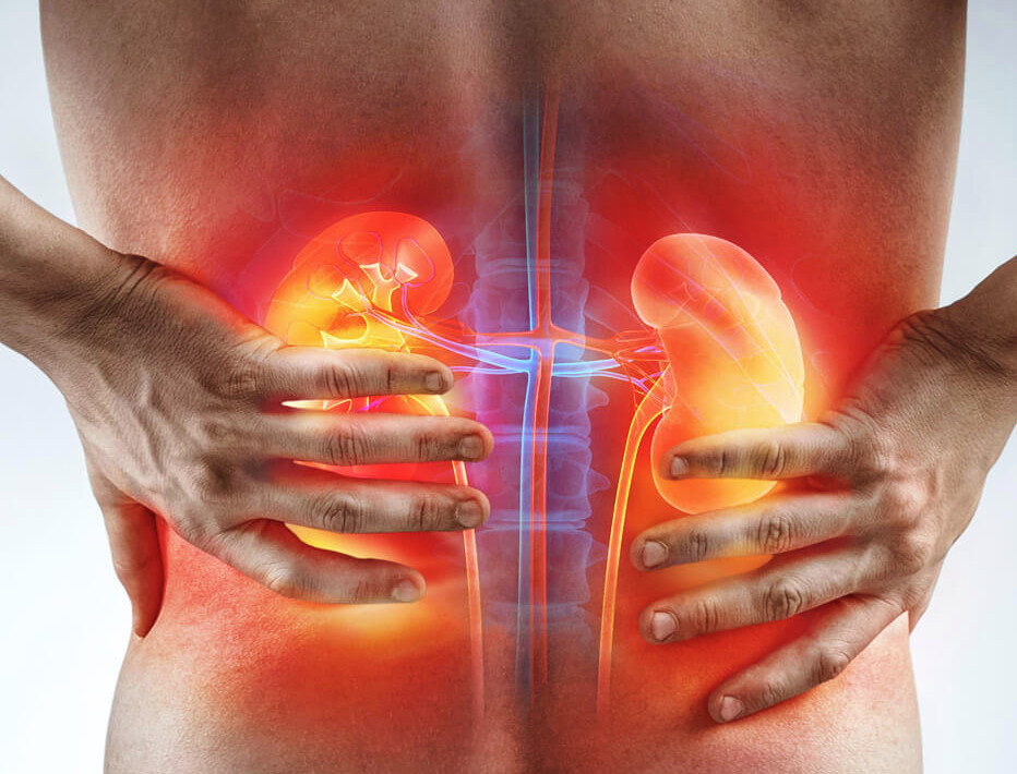 Почечная колика: как реагировать?