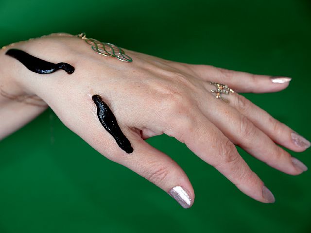 Гирудотерапия: терапия пиявками