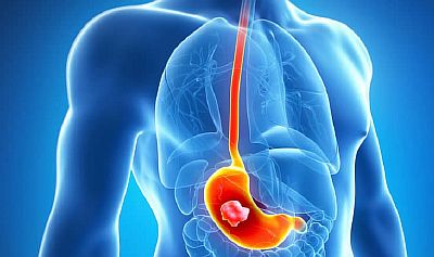 Привратник желудка