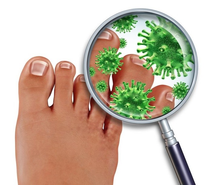 Признаки грибковой инфекции