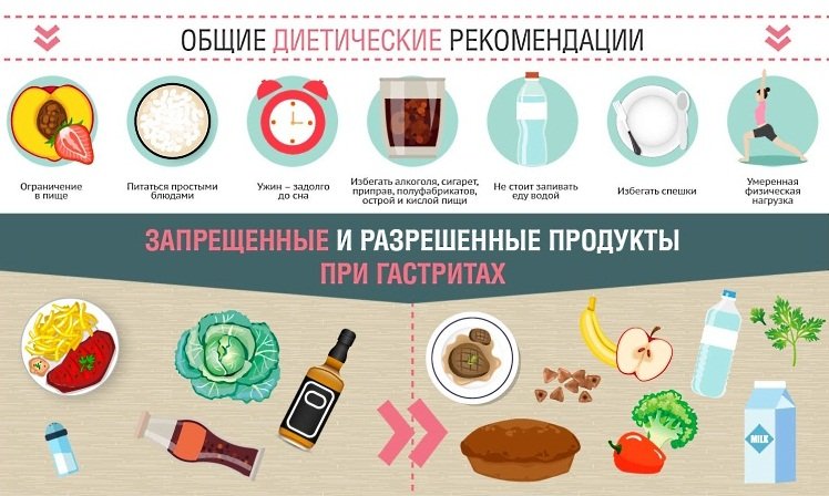 Лечение гастрита