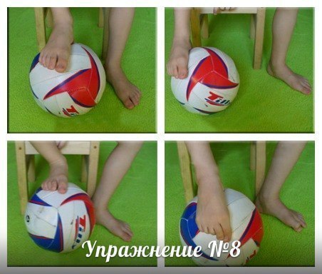 Упражнения при плоскостопии