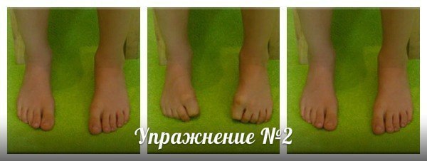 упражнения при плоскостопии