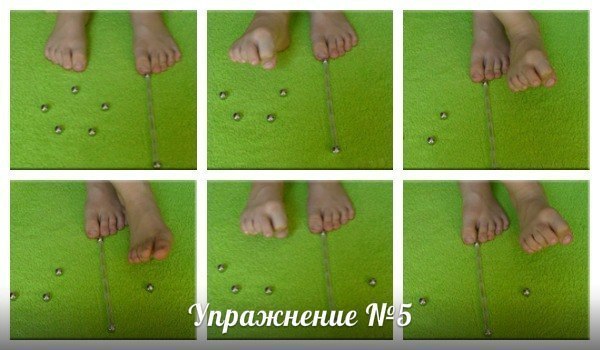 Упражнения при плоскостопии