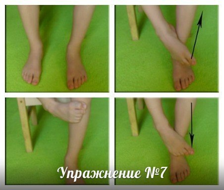 Упражнения при плоскостопии