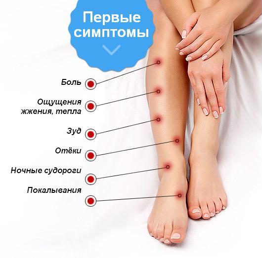 Варикозная болезнь