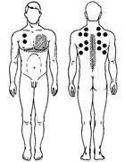 Банки - удар по мокроте Банки - удар по мокроте