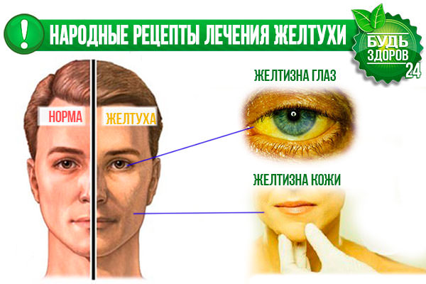 Боль в глазах – народные рецепты / народная медицина / народные средства