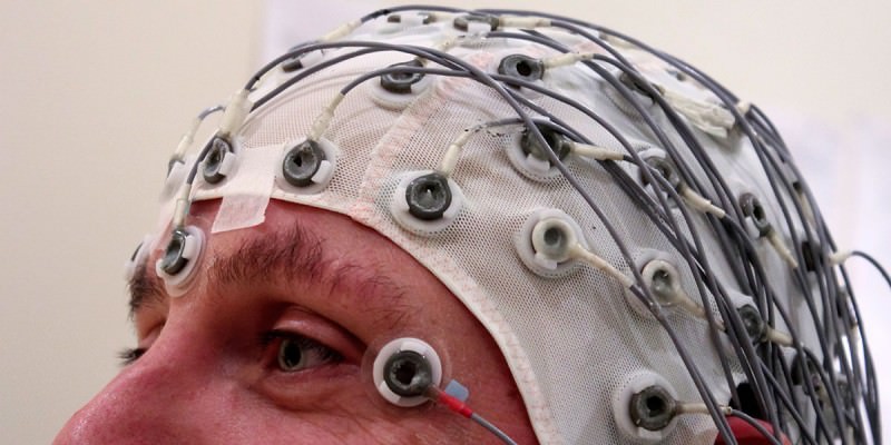 Электроэнцефалография в данном случае - крайне важный метод диагностики Электроэнцефалография в данном случае - крайне важный метод диагностики