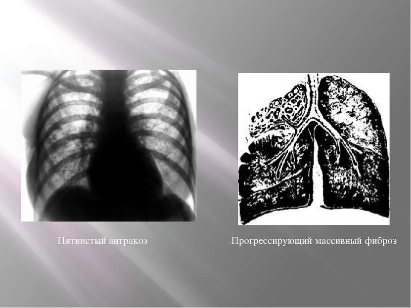 Формы патологического процесса Формы патологического процесса