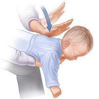 Фото: что делать, если ребёнок поперхнулся. Фото: что делать, если ребёнок поперхнулся.