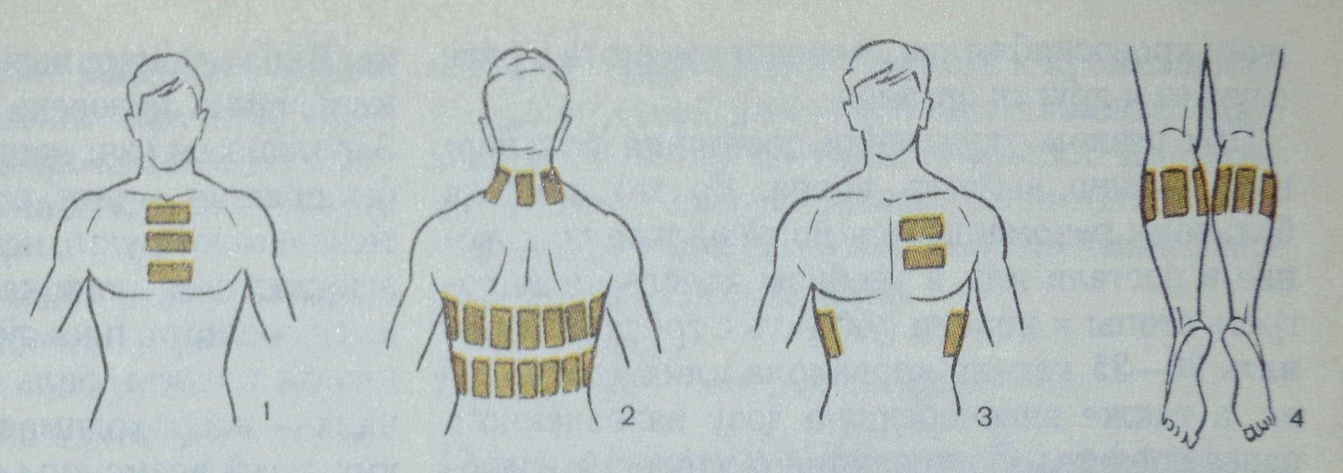 Использование солевого компресса при осложнениях после ОРВИ Использование солевого компресса при осложнениях после ОРВИ