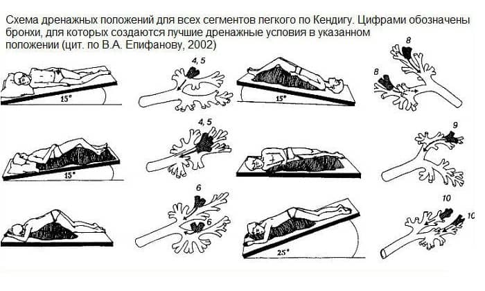 Как облегчить дренирование Как облегчить дренирование