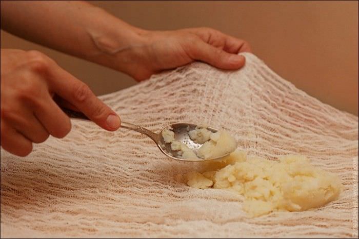 Картофельный компресс самый безопасный, у него нет ограничений по возрасту Картофельный компресс самый безопасный, у него нет ограничений по возрасту