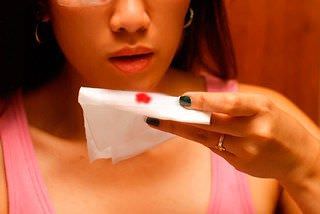 Кровь при кашле у больного туберкулезом Кровь при кашле у больного туберкулезом