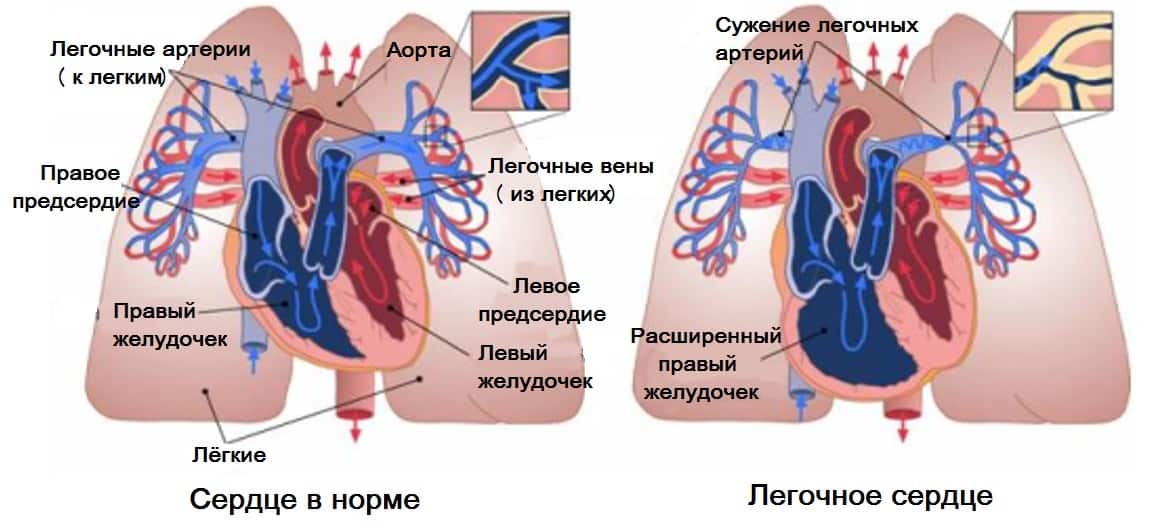 Опасное последствие патологии Опасное последствие патологии