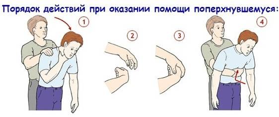 Помощь поперхнувшемуся. Помощь поперхнувшемуся.