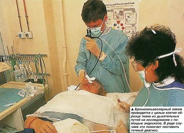 Процедура промывания Процедура промывания