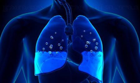 Развитие отека легких при патологии сердца Развитие отека легких при патологии сердца