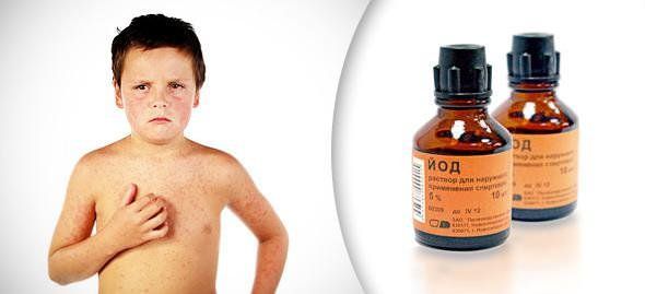 Следует избегать попадания йода на слизистые ткани и поврежденные участки кожи Следует избегать попадания йода на слизистые ткани и поврежденные участки кожи