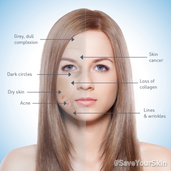 Влияние курения на кожу человека