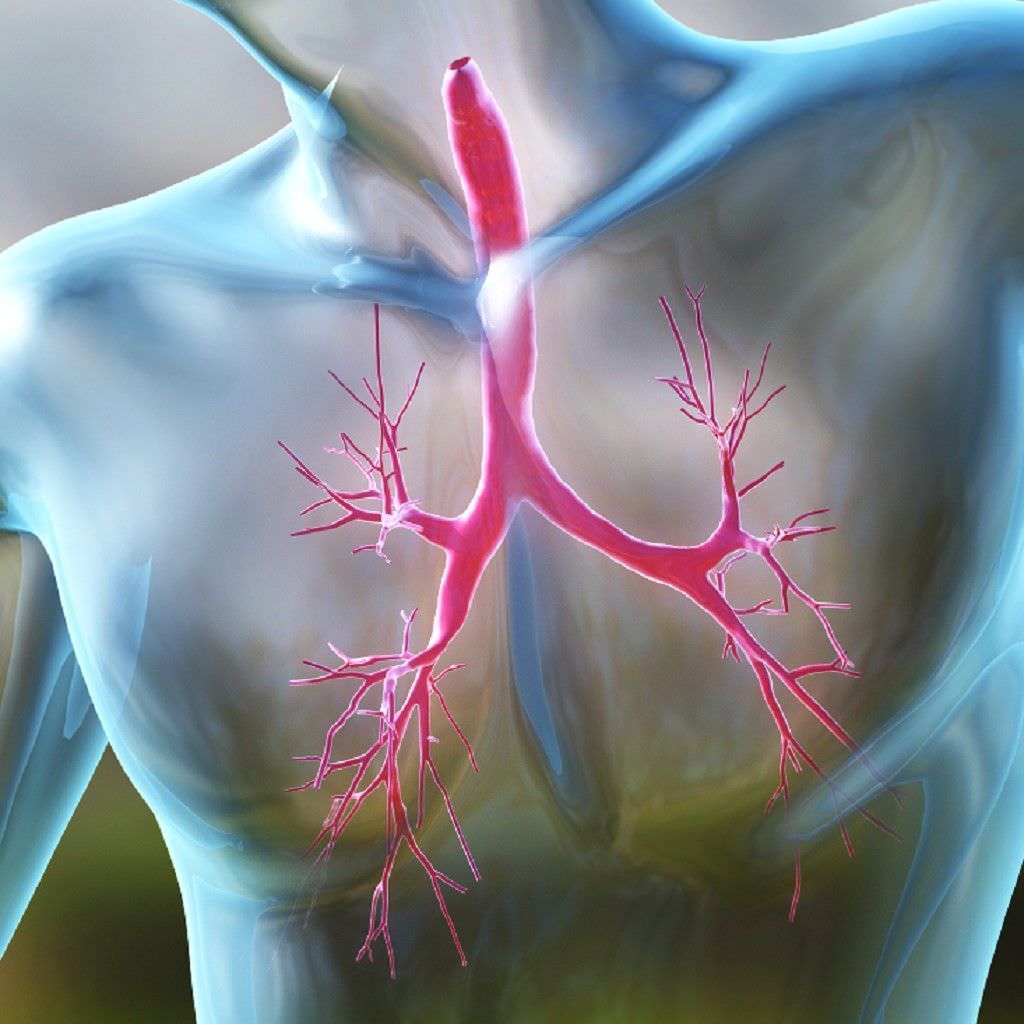 Воспалительный процесс, локализованный в бронхиальном дереве, также является причиной хронического кашля Воспалительный процесс, локализованный в бронхиальном дереве, также является причиной хронического кашля