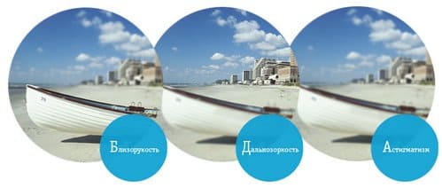 астигматизм глаз