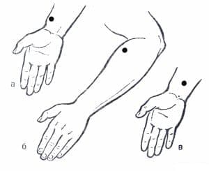 точечный массаж дальнозоркость